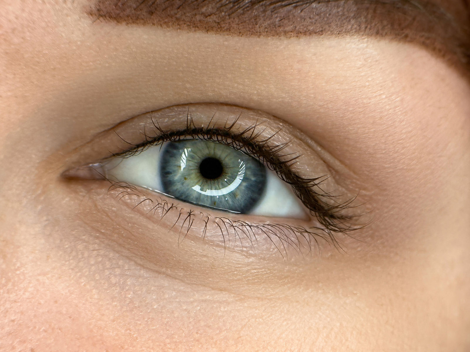 Subtile Wimpernkranz-Verdichtung entlang des Wimpernkranzes
